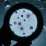 Microscope slide shows cancer cells with faint glow in laboratory texture background