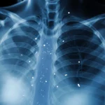 Mammogram of a woman